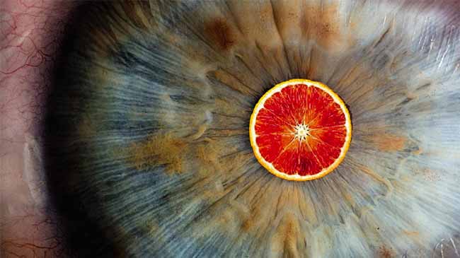 le arance limitano lo sviluppo della degenerazione maculare,