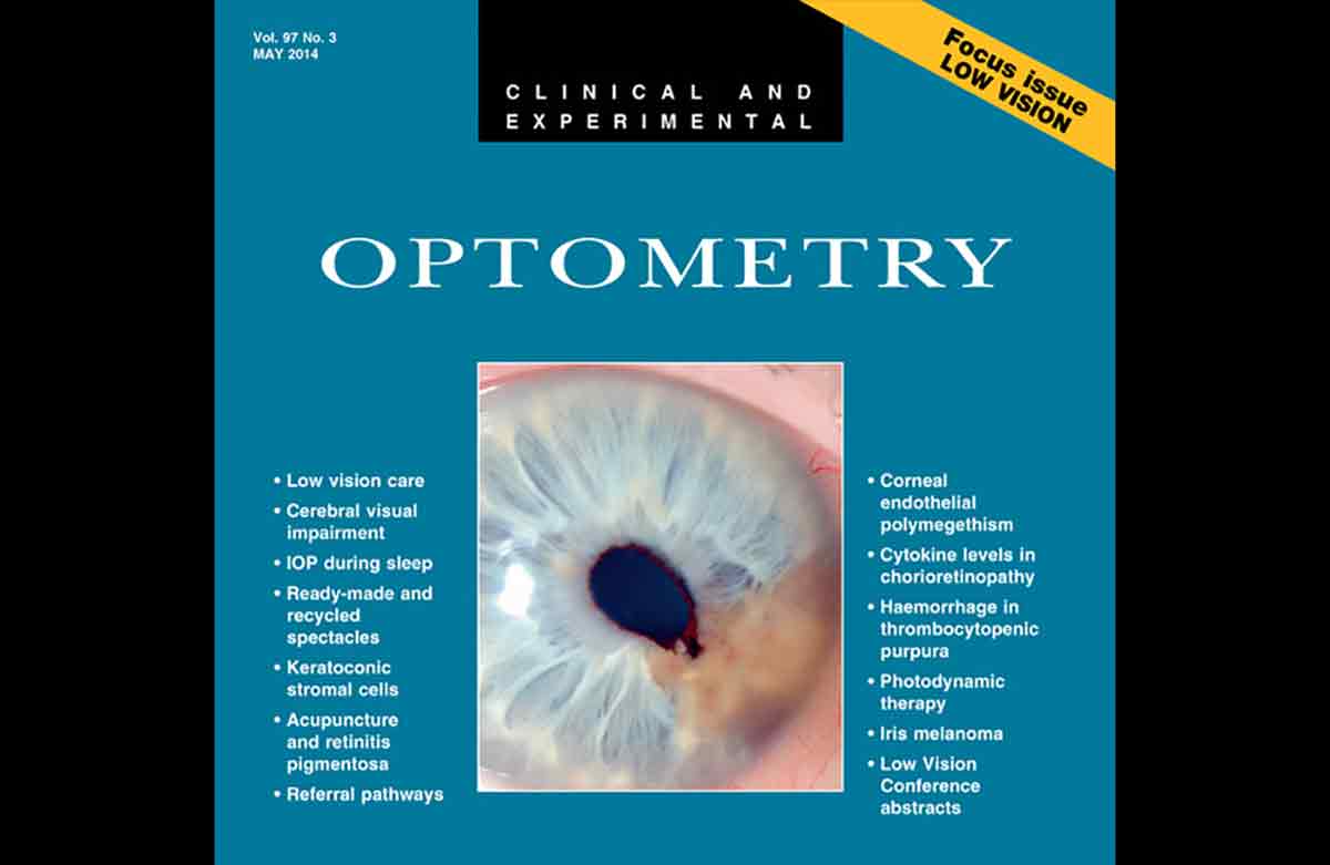 Al momento stai visualizzando Uno studio pilota di un protocollo di agopuntura per migliorare la funzione visiva nei pazienti con retinite pigmentosa
