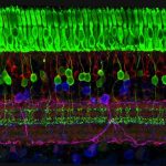 strati di cellule nervose della retina, retinite pigmentosa,