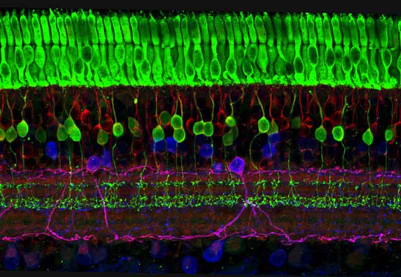 strati di cellule nervose della retina, retinite pigmentosa,